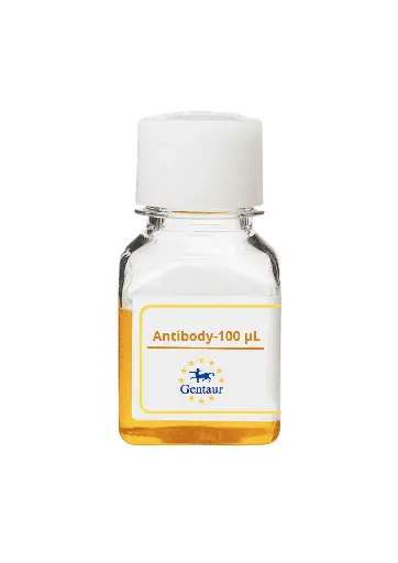 [CSB-1038] ALKBH4 Antibody  HRP conjugated   